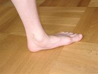 ناهنجاری کف پای صاف و روش های اندازه گیری آن در دانش آموزان