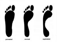 ناهنجاری کف پای صاف و روش های اندازه گیری آن در دانش آموزان