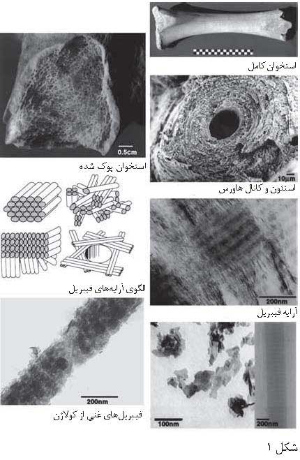 نانو چندسازه ها و استخوان مصنوعی