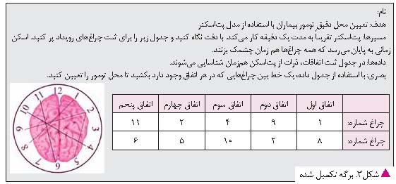 فعالیت توموگرافی گسیل پوزیترون