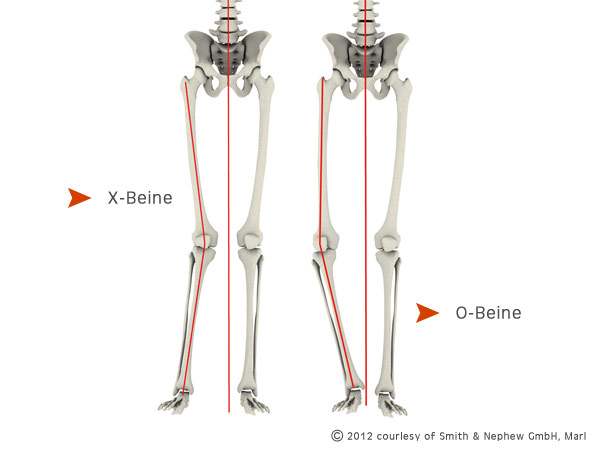 حرکت های اصلاحی و کارکردهای آن