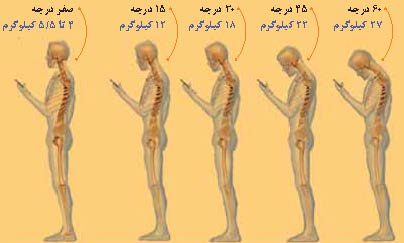 آسیب های جسمی در عصر رسانه ها