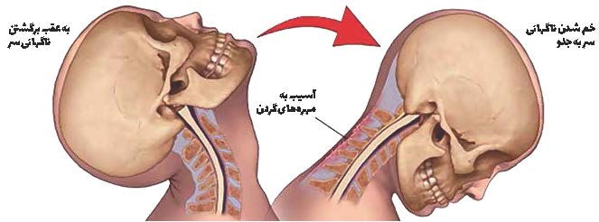 سرت را بالا بگیر
